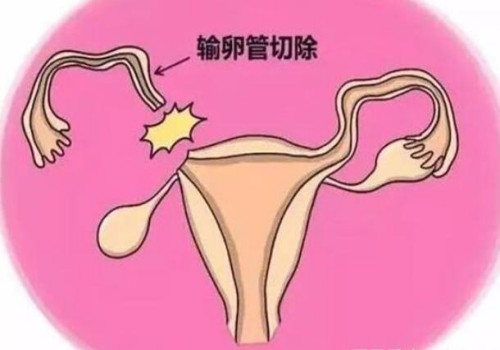 男性睾丸受伤之后对生育带来的影响要视伤情的严重程度来决定